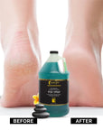FOOT SPA - Pedi Spray Antiseptic, Mint & Eucalyptus