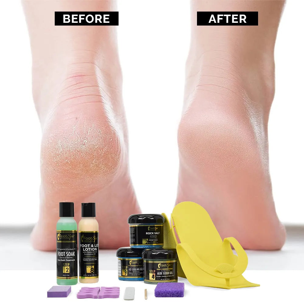 FOOT SPA MiniFoot Spa Kit Mini – Complete Pedicure Set for Soft, Smooth Feet