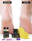 FOOT SPA MiniFoot Spa Kit Mini – Complete Pedicure Set for Soft, Smooth Feet