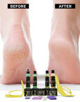 Foot Spa Professional Pedicure Student Kit – Complete 10-Piece Aromatherapeutic Spa Pedicure Se