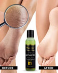 Foot Spa Massage Oil – Professional Massage Therapy with Tea Tree, Peppermint & Eucalyptus – Deeply Hydrating for Full Body, Manicure & Pedicure – Soothes Sore Muscles & Repairs Dry Skin - Beauty Market Online