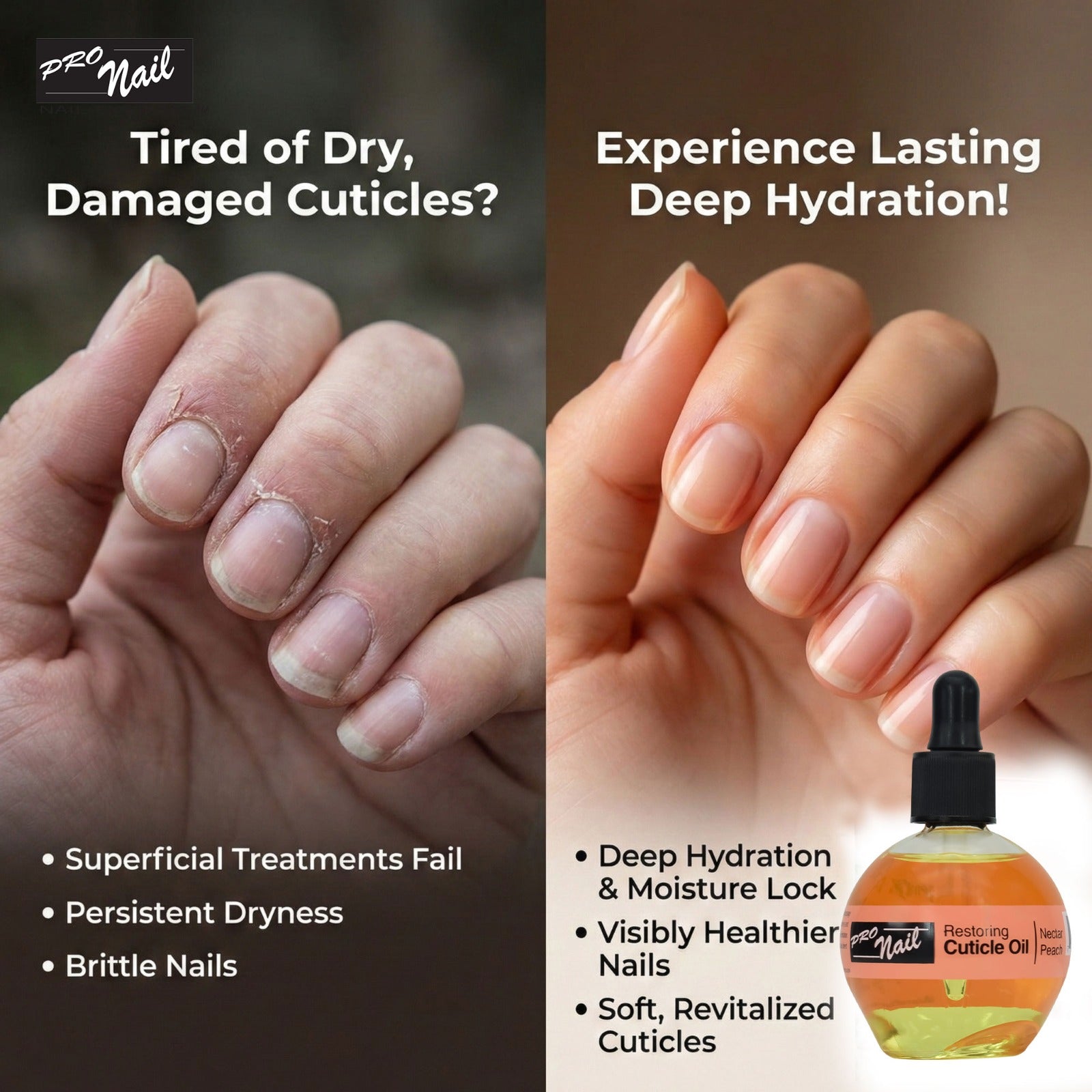 PRO NAIL Cuticle Revitalizing Oil - Strengthens &amp; Moisturizes Nails and Cuticles - Professional Use