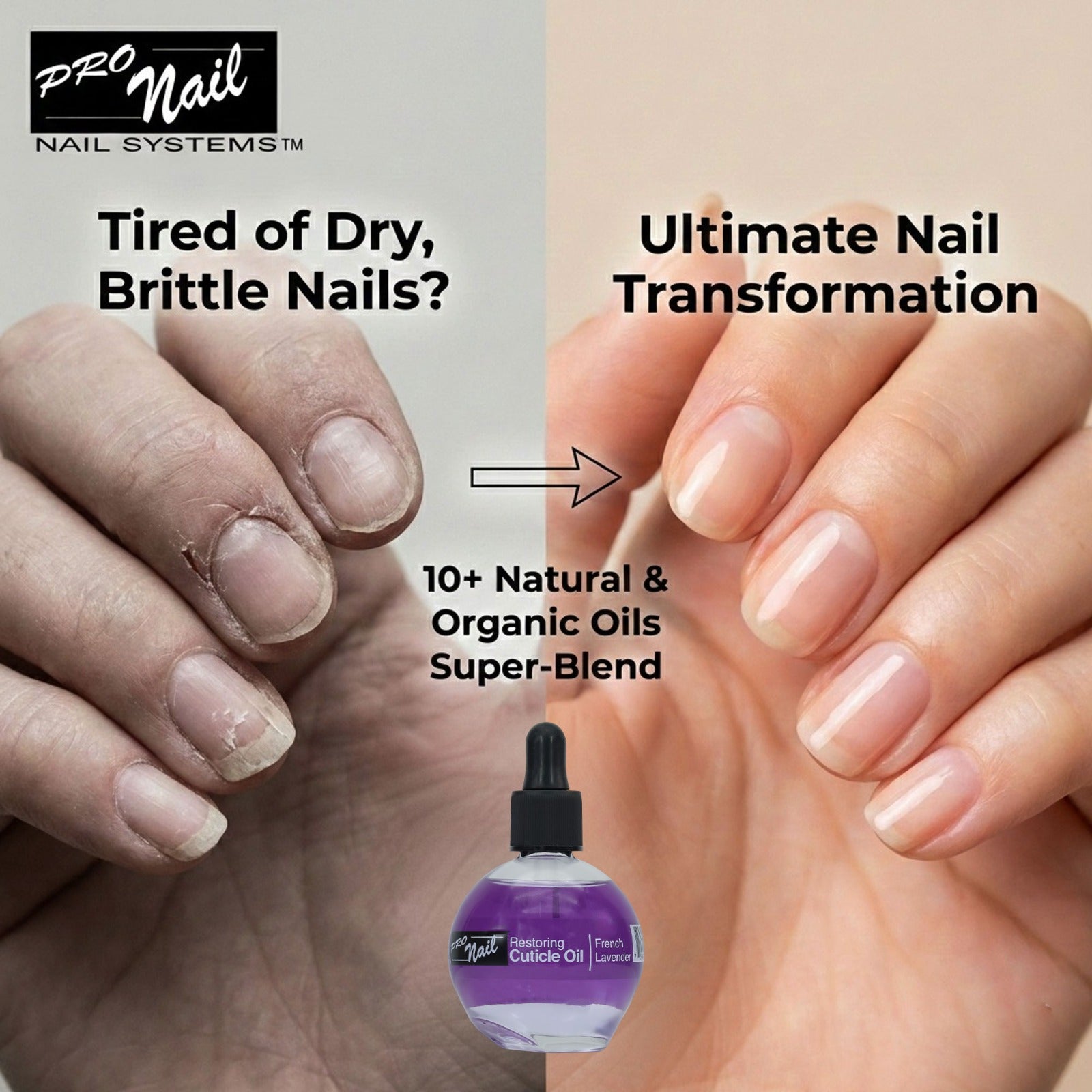PRO NAIL Cuticle Revitalizing Oil - Strengthens &amp; Moisturizes Nails and Cuticles - Professional Use