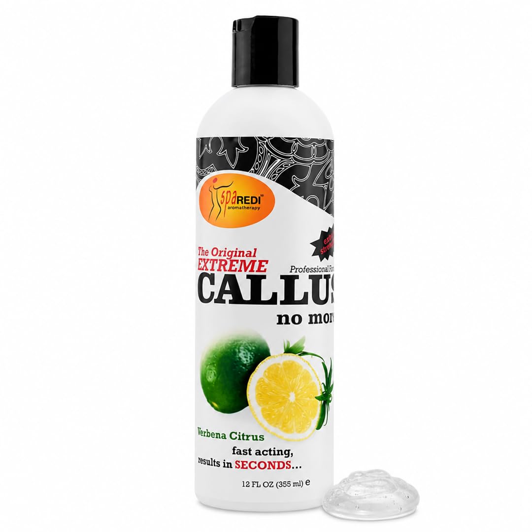 SPA REDI Callus Remover Gel - Quickly Removes Tough Calluses & Smooths Cracked Heels