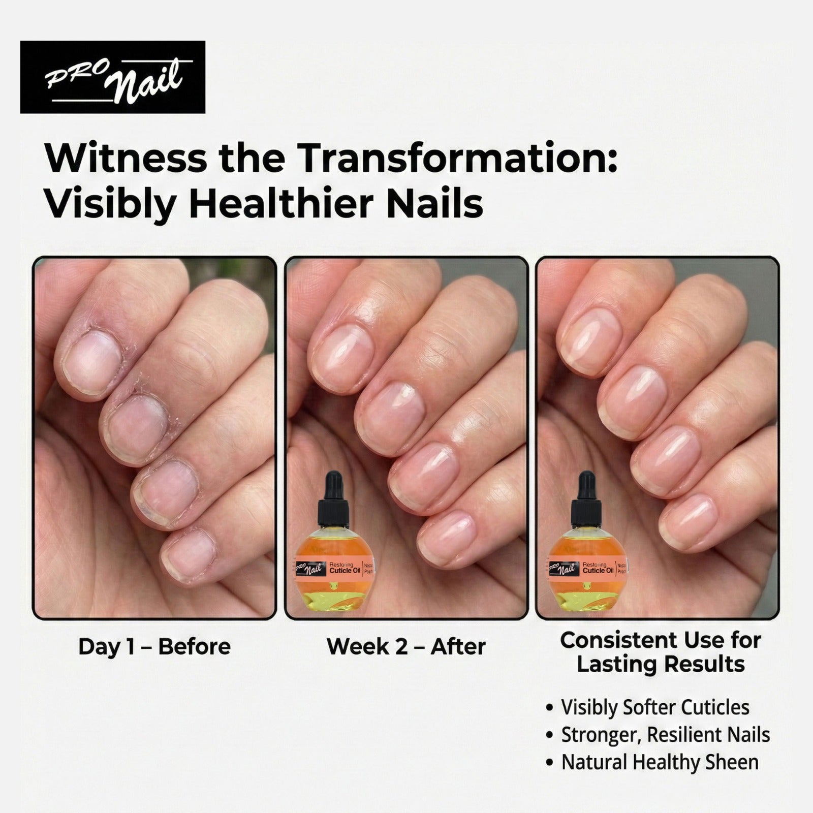 PRO NAIL Cuticle Revitalizing Oil - Strengthens &amp; Moisturizes Nails and Cuticles - Professional Use