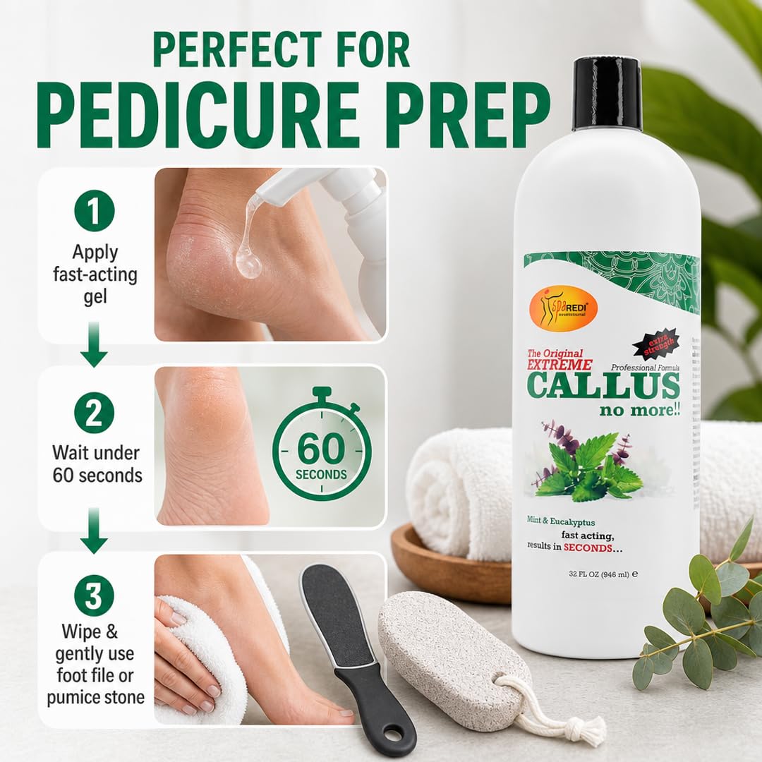 SPA REDI Callus Remover Gel - Quickly Removes Tough Calluses &amp; Smooths Cracked Heels