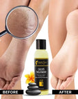 Foot SPA - Callus Remover Gel, 2 Oz - Professional Pedicure Care, Instantly Smooths Dry Cracked Heels & Removes Calluses