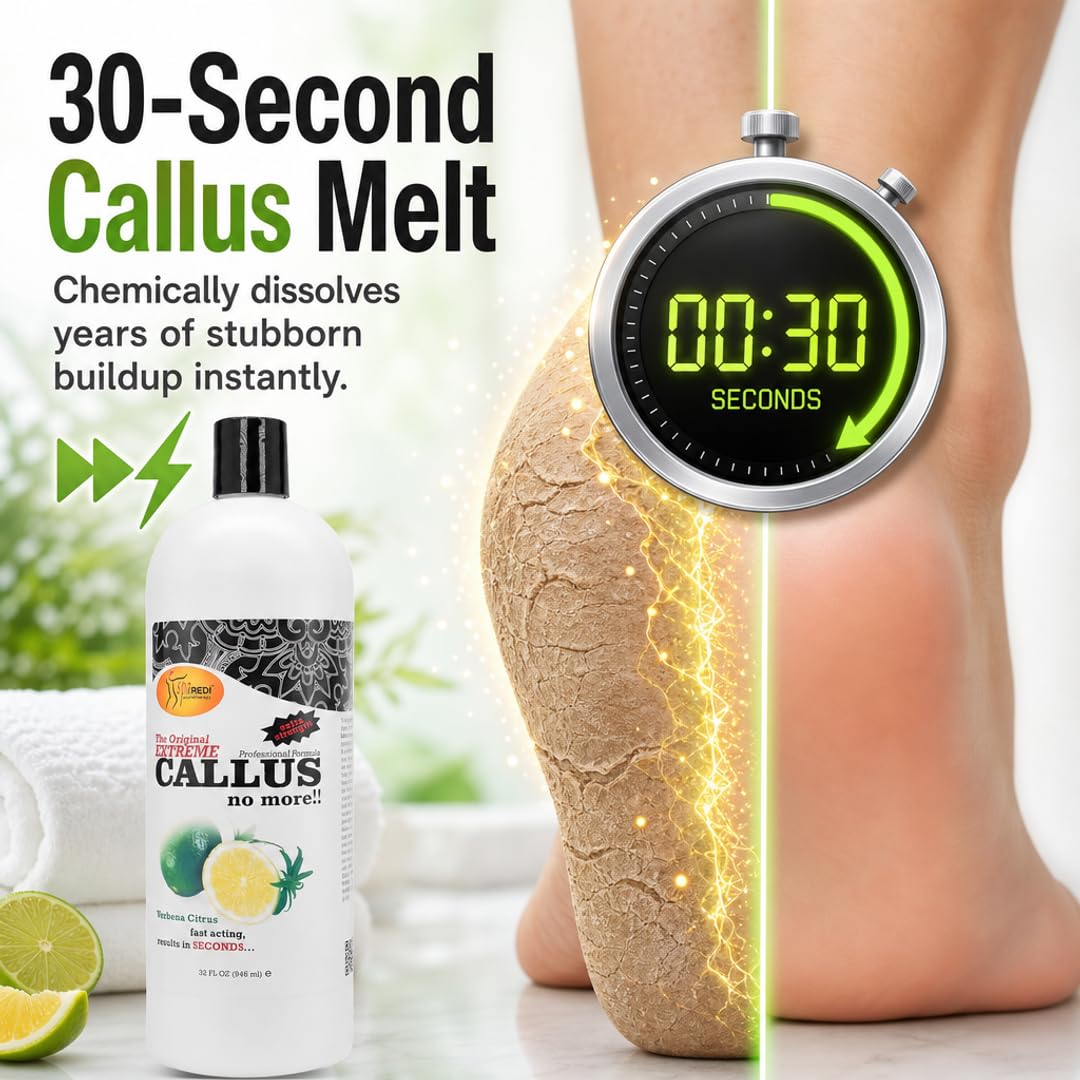 SPA REDI Callus Remover Gel - Quickly Removes Tough Calluses &amp; Smooths Cracked Heels