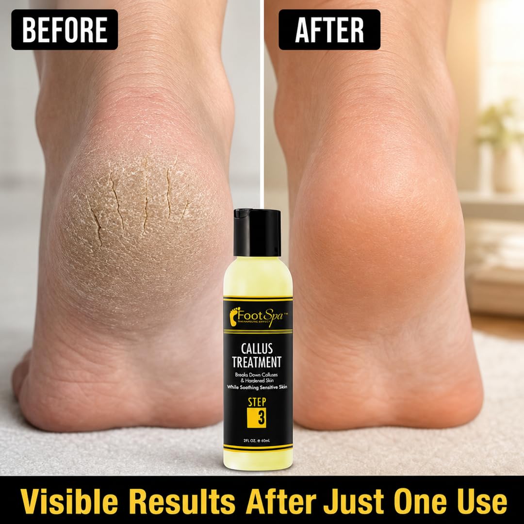 Foot SPA - Callus Remover Gel - Professional Pedicure Care