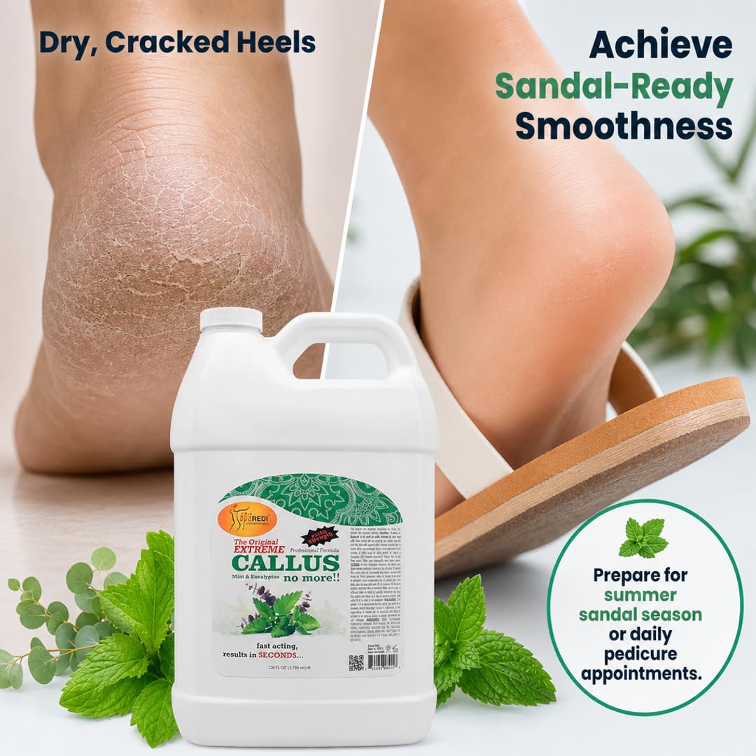 SPA REDI Callus Remover Gel - Quickly Removes Tough Calluses &amp; Smooths Cracked Heels