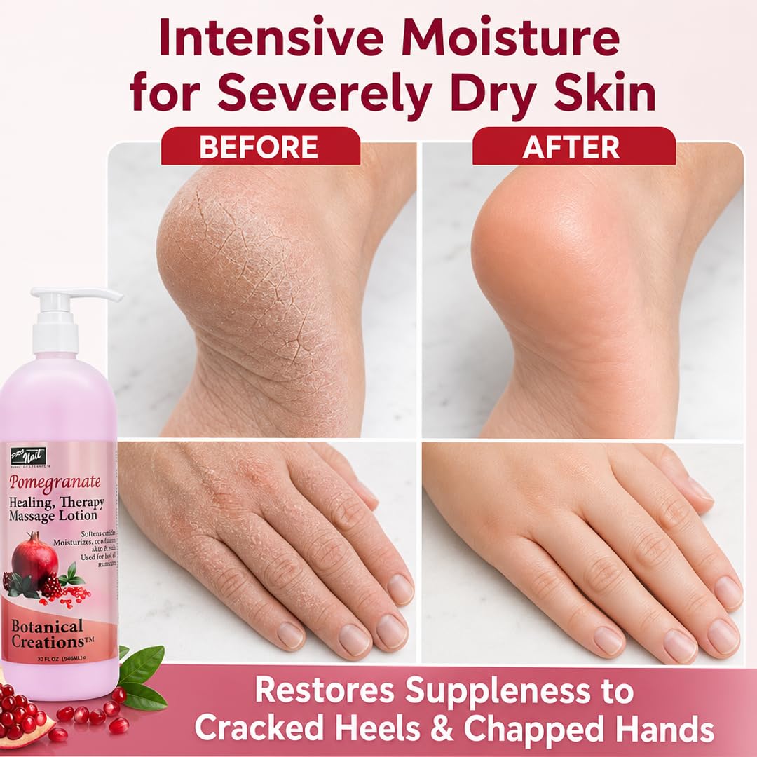 PRO NAIL Healing Therapy Massage Lotion - Nourishes &amp; Moisturizes Skin, Perfect for Pedicure, Manicure &amp; Body Care