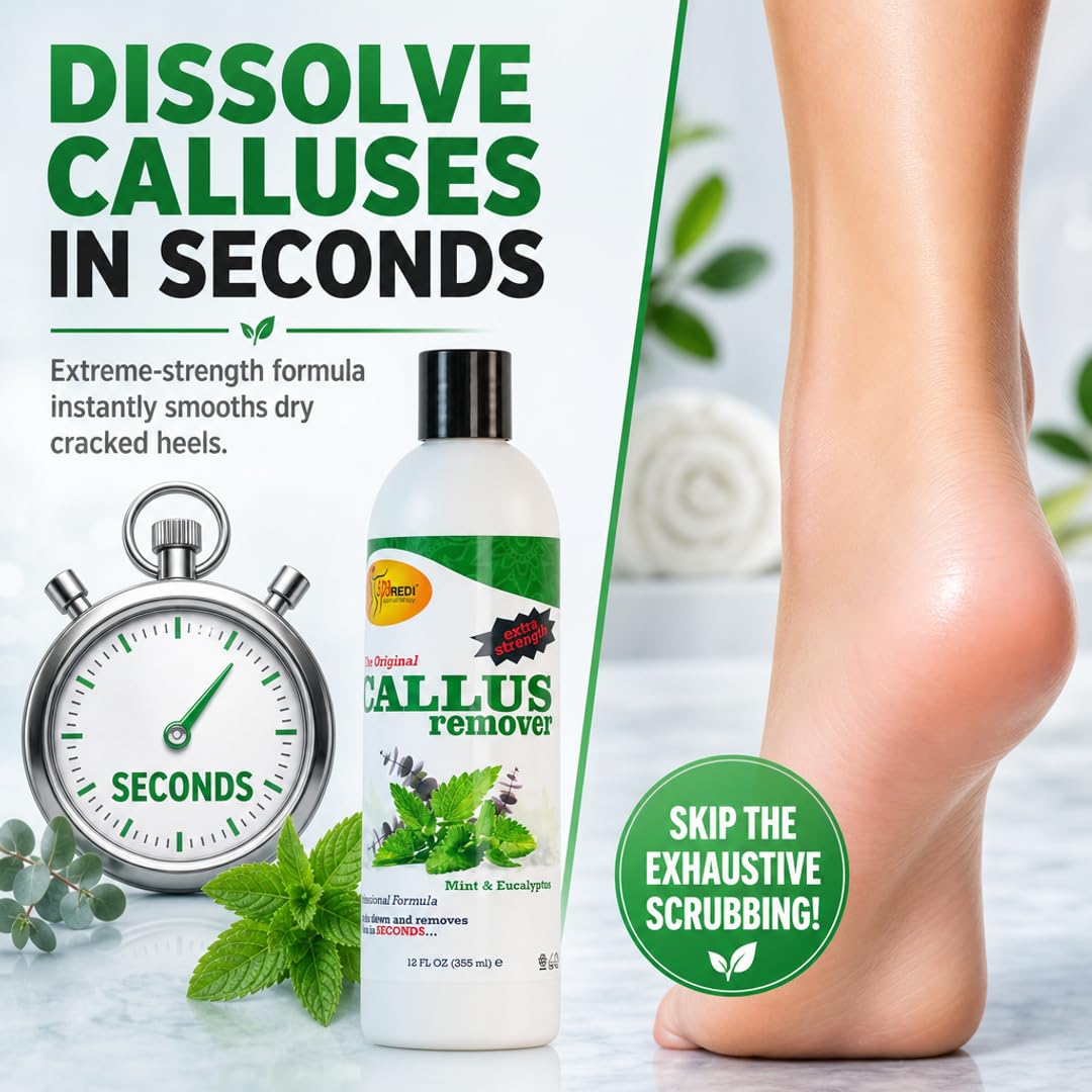 SPA REDI Callus Remover Gel - Quickly Removes Tough Calluses &amp; Smooths Cracked Heels