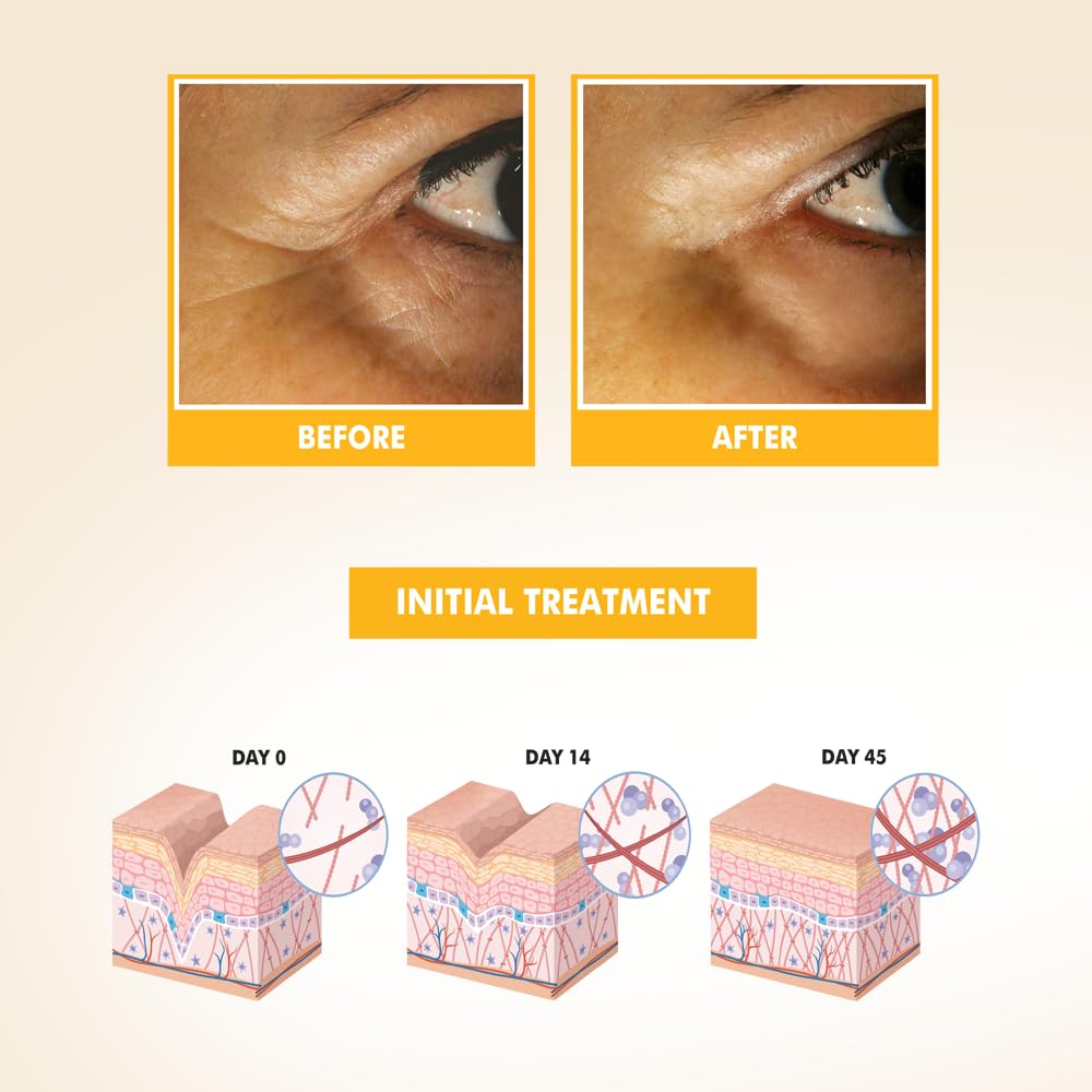 NIKA SKIN CARE - Eye Serum with Vitamin C &amp; E, Hyaluronic Acid, Caffeine &amp; Swiss Apple Stem Cells - Day &amp; Night Hydration