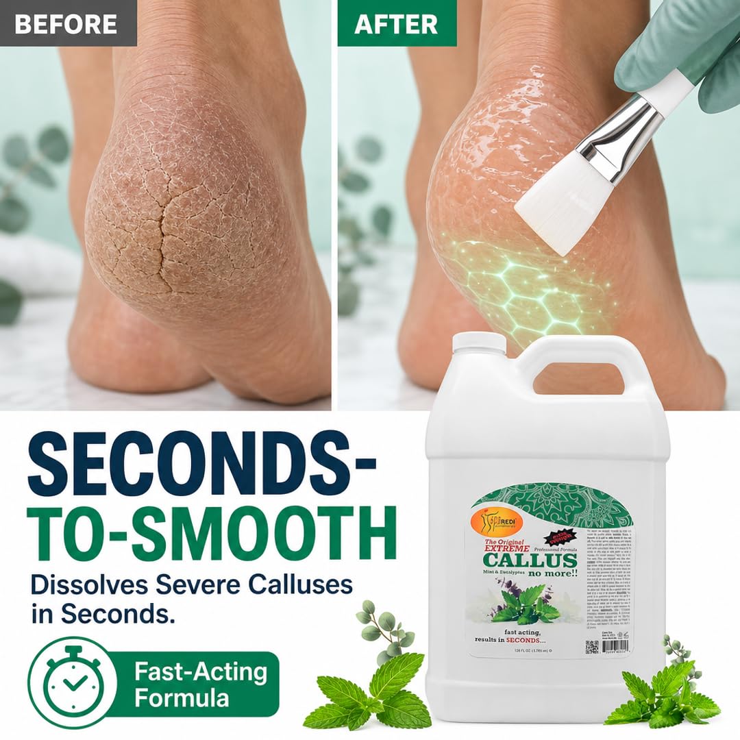 SPA REDI Callus Remover Gel - Quickly Removes Tough Calluses &amp; Smooths Cracked Heels