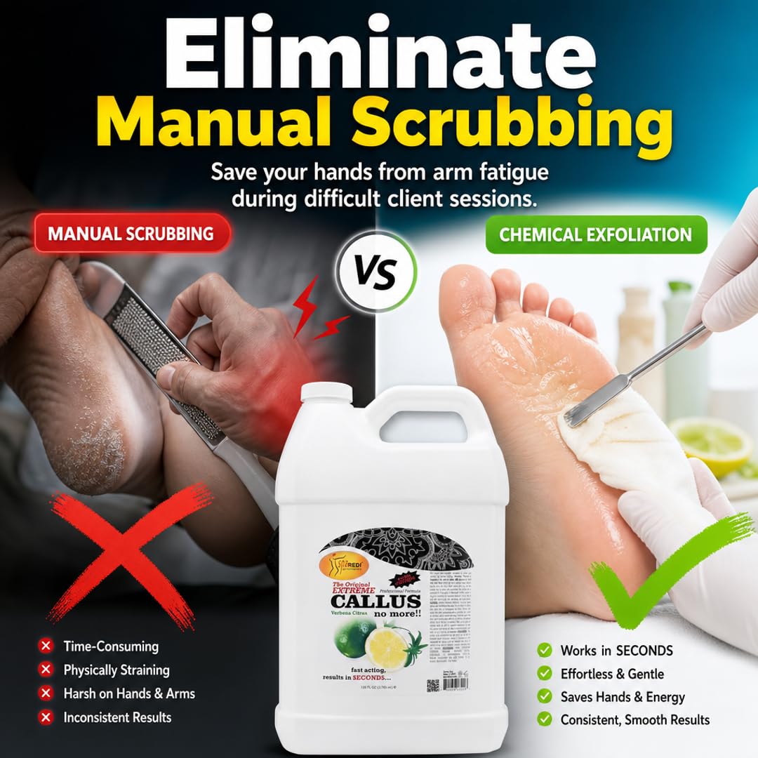 SPA REDI Callus Remover Gel - Quickly Removes Tough Calluses &amp; Smooths Cracked Heels