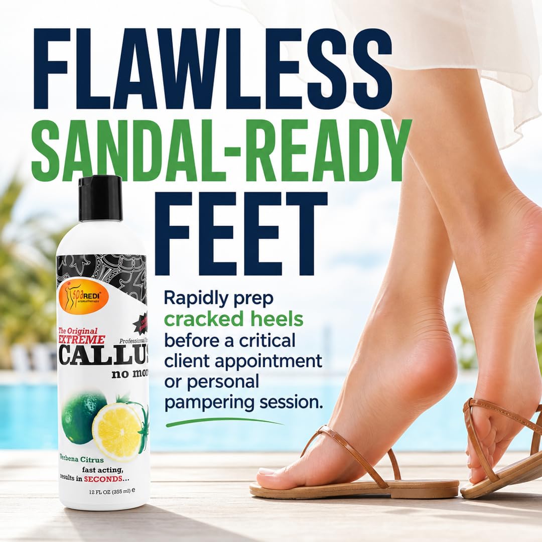 SPA REDI Callus Remover Gel - Quickly Removes Tough Calluses &amp; Smooths Cracked Heels
