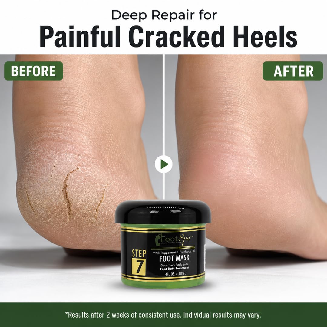 Foot Spa Cream Mask with Peppermint &amp; Eucalyptus Oil – Hydrating Pedicure &amp; Massage Treatment for Tired Feet &amp; Body – Infused with Hyaluronic Acid, Amino Acids &amp; Panthenol