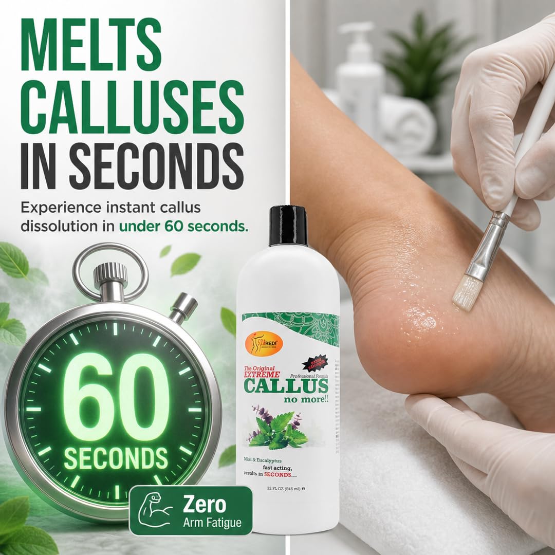 SPA REDI Callus Remover Gel - Quickly Removes Tough Calluses &amp; Smooths Cracked Heels