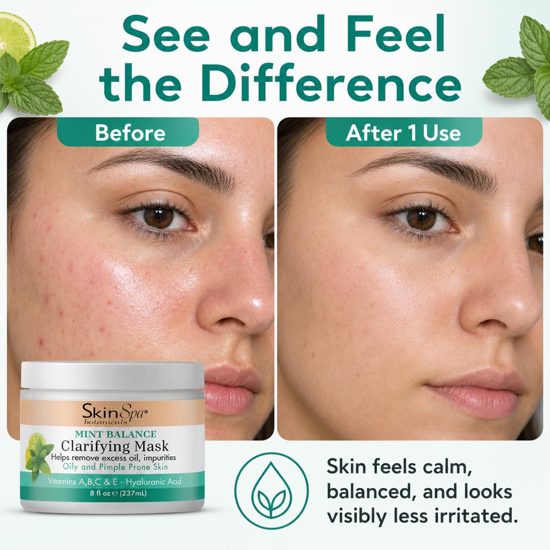 SKIN SPA Acne Control Mint Julep Face Mask