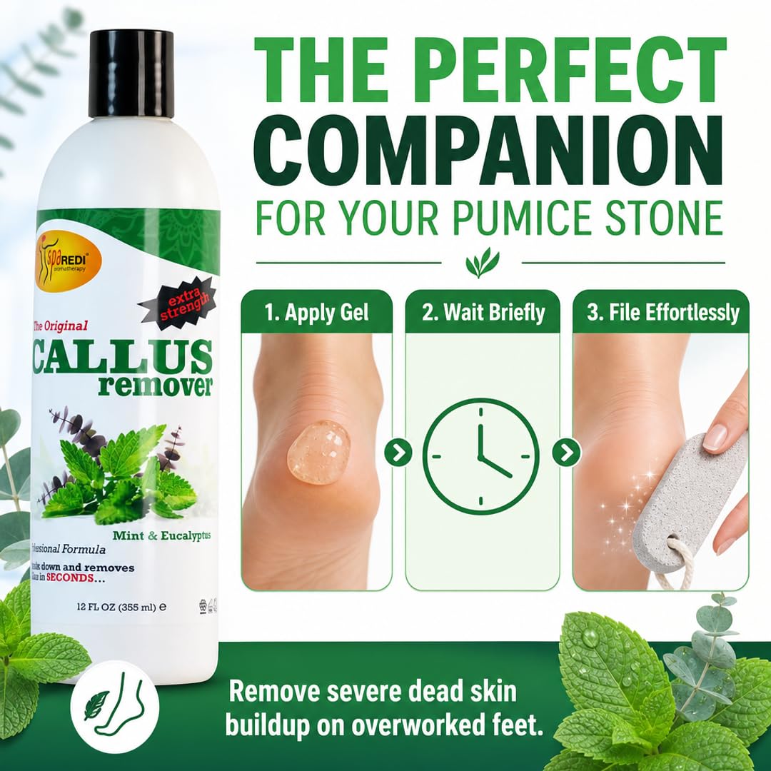 SPA REDI Callus Remover Gel - Quickly Removes Tough Calluses &amp; Smooths Cracked Heels
