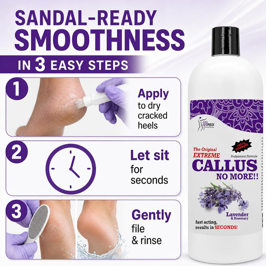 SPA REDI Callus Remover Gel - Quickly Removes Tough Calluses &amp; Smooths Cracked Heels
