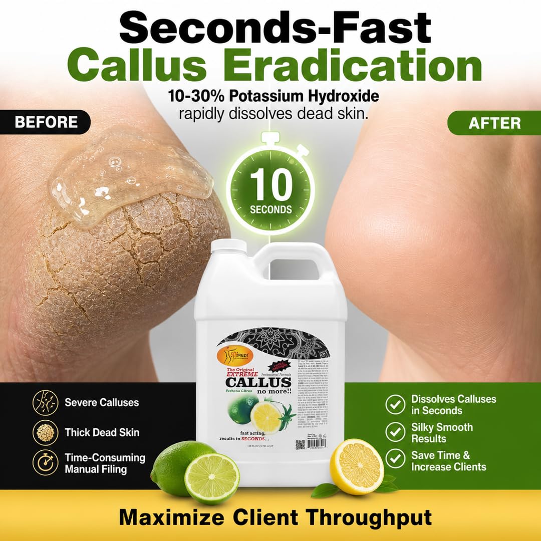 SPA REDI Callus Remover Gel - Quickly Removes Tough Calluses &amp; Smooths Cracked Heels