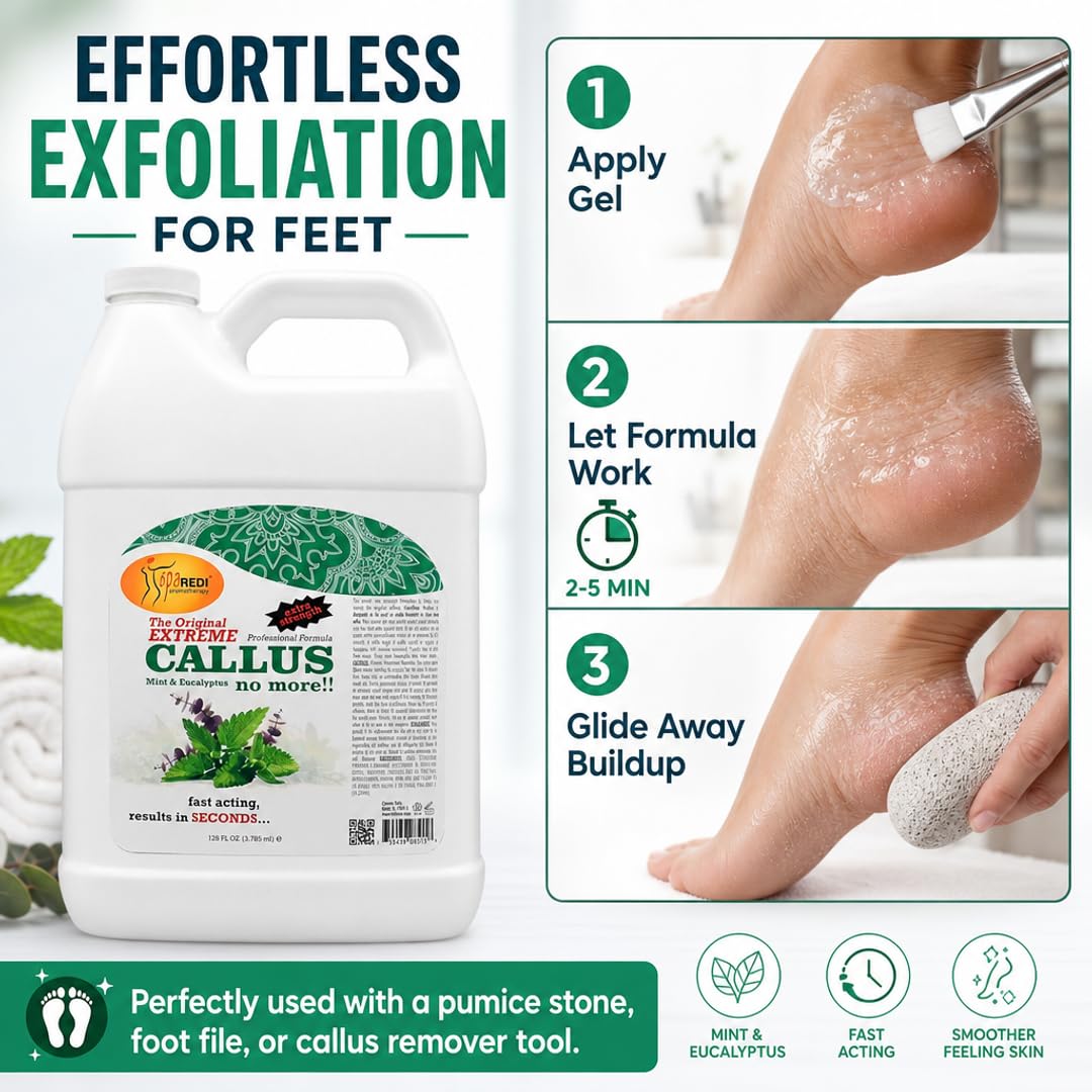 SPA REDI Callus Remover Gel - Quickly Removes Tough Calluses &amp; Smooths Cracked Heels