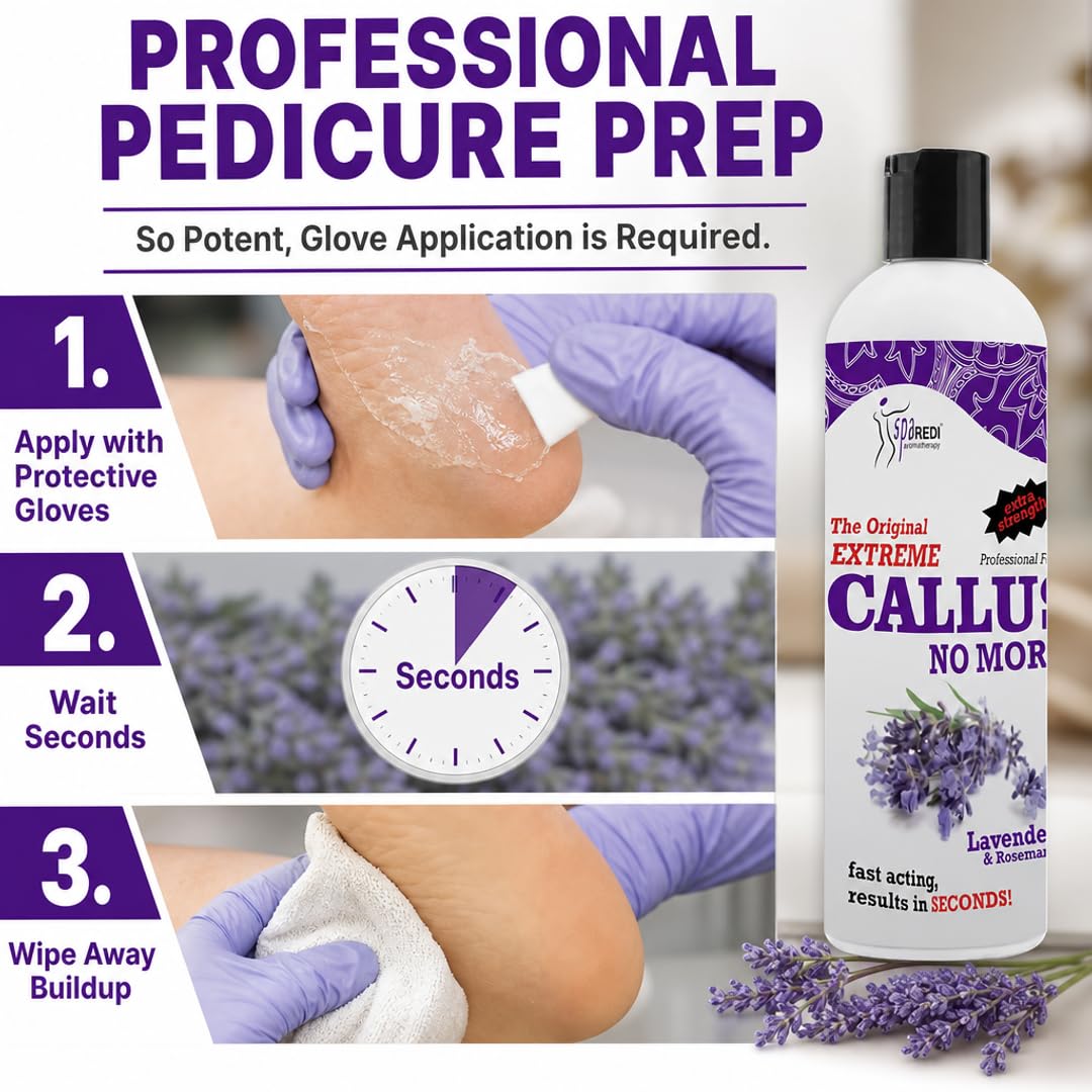 SPA REDI Callus Remover Gel - Quickly Removes Tough Calluses &amp; Smooths Cracked Heels