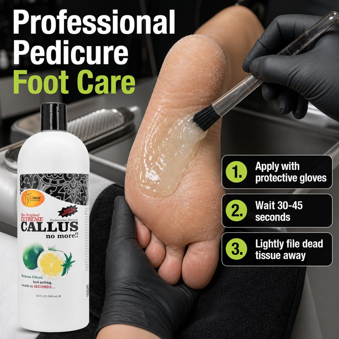SPA REDI Callus Remover Gel - Quickly Removes Tough Calluses &amp; Smooths Cracked Heels