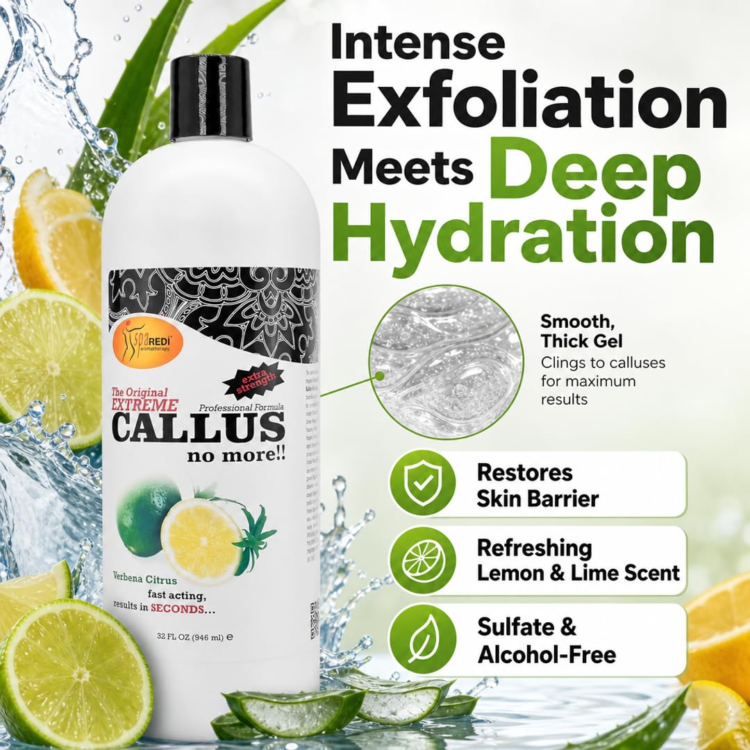 SPA REDI Callus Remover Gel - Quickly Removes Tough Calluses &amp; Smooths Cracked Heels