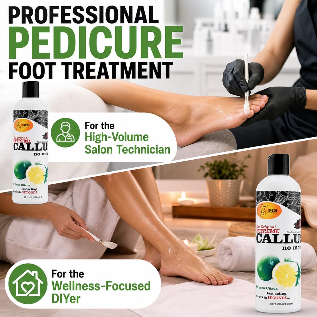 SPA REDI Callus Remover Gel - Quickly Removes Tough Calluses &amp; Smooths Cracked Heels